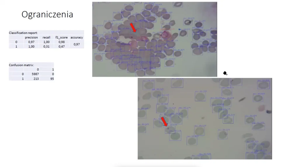 Aplikacja identyfikująca komórki zakażone malarią