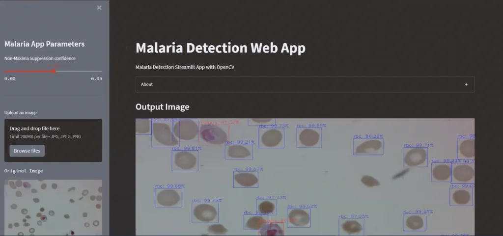 Interfejs webowy aplikacji do wykrywania malarii